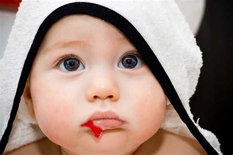 bebeklerde kan degeri yuksek cikmasi